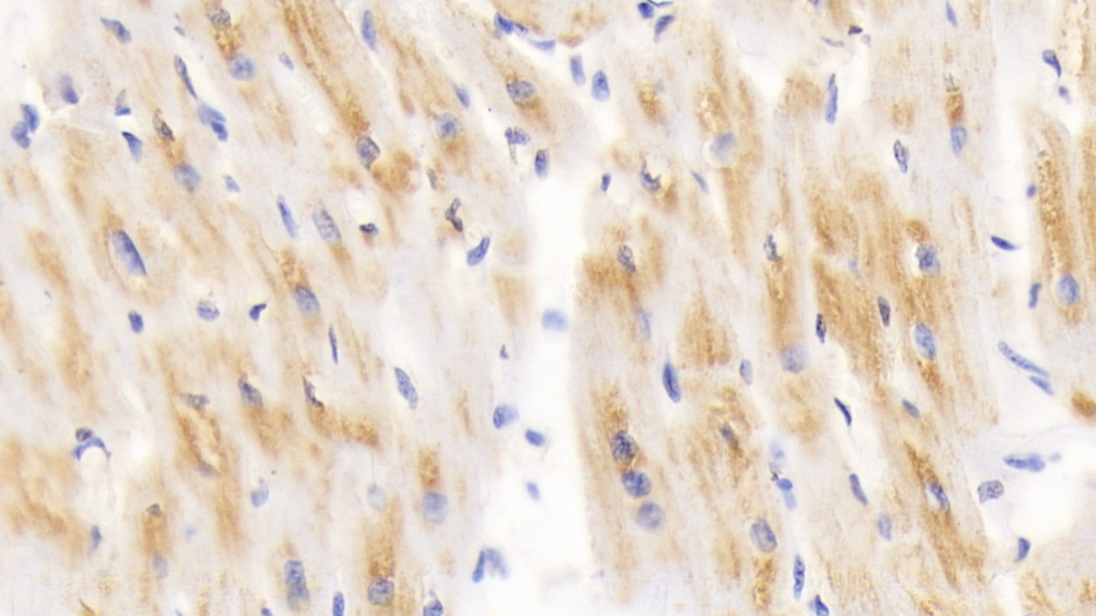 Dihydrolipoyl Transacetylase (DLAT) Human Polyclonal Antibody