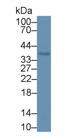 Kallikrein 10 (KLK10) Rat Polyclonal Antibody