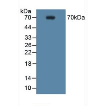 Cyclooxygenase-2 (COX 2) Human Polyclonal Antibody