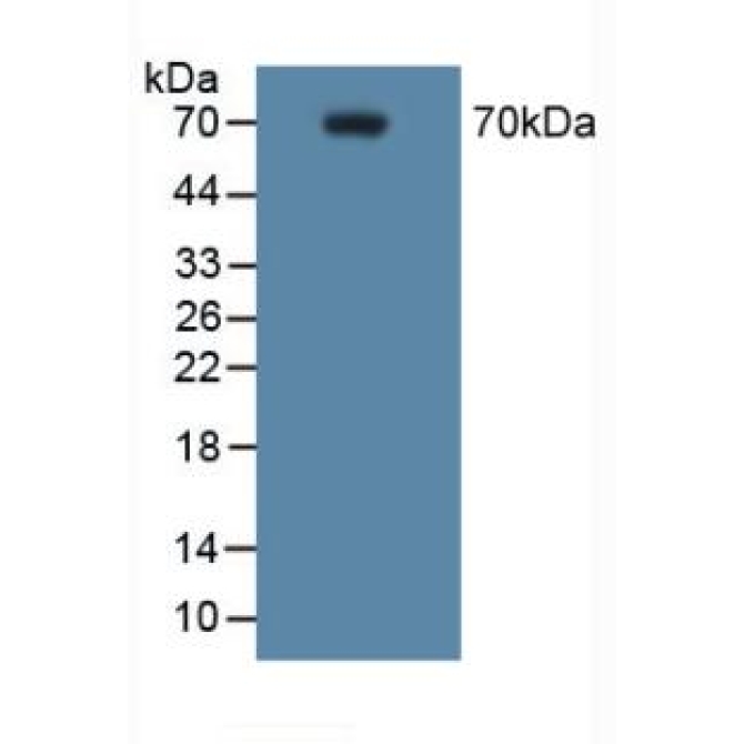Cyclooxygenase-2 (COX 2) Human Polyclonal Antibody
