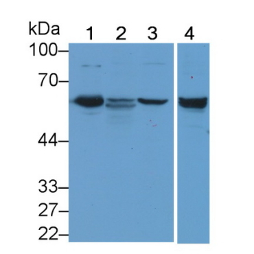 Membrane Protein, Palmitoylated 6 (MPP6) Human Polyclonal Antibody