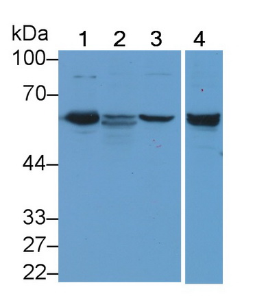 Membrane Protein, Palmitoylated 6 (MPP6) Human Polyclonal Antibody