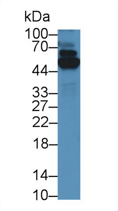 Thioredoxin Reductase 1 (TXNRD1) Mouse Polyclonal Antibody