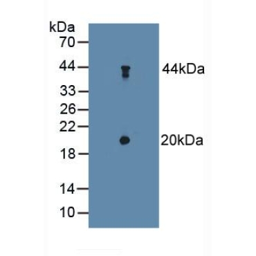 Delta-Sleep Inducing Peptide (dSIP) Human Polyclonal Antibody