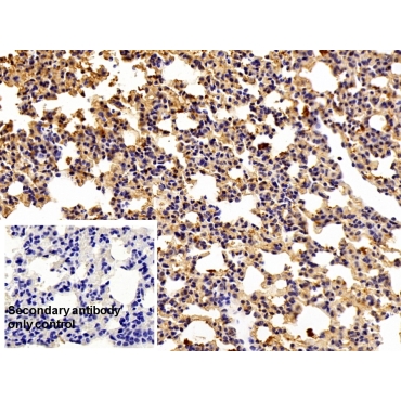 Prothrombin Fragment 1+2 (F1+2) Human Polyclonal Antibody