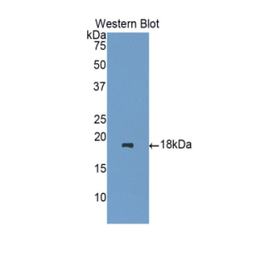 Heparanase (HPSE) Human Polyclonal Antibody