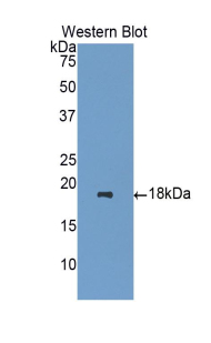 Heparanase (HPSE) Human Polyclonal Antibody