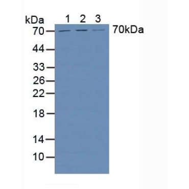 Heparanase (HPSE) Human Polyclonal Antibody