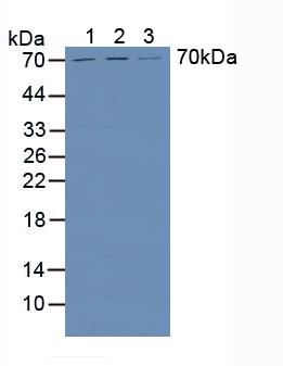 Heparanase (HPSE) Human Polyclonal Antibody