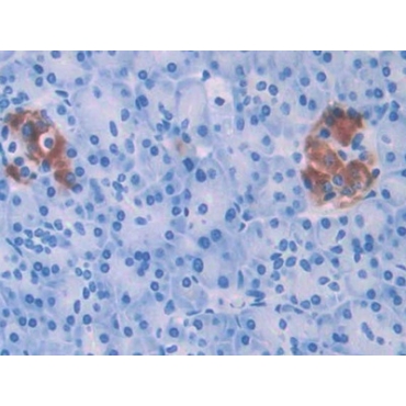 Heparanase (HPSE) Human Polyclonal Antibody
