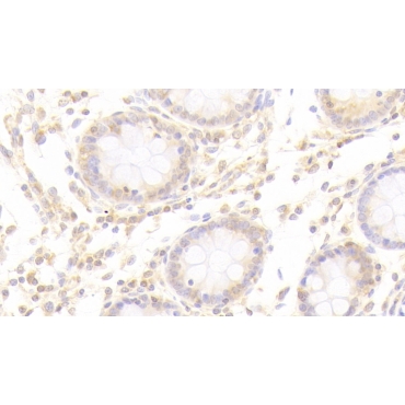 Heparanase (HPSE) Human Polyclonal Antibody