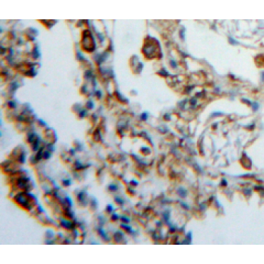 Heparanase (HPSE) Mouse Polyclonal Antibody