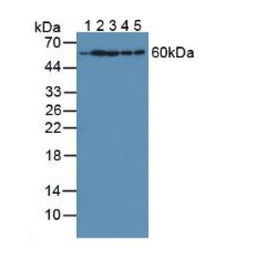 Hypoxanthine Phosphoribosyltransferase 1 (HPRT1) Human Polyclonal Antibody