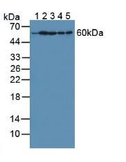 Hypoxanthine Phosphoribosyltransferase 1 (HPRT1) Human Polyclonal Antibody