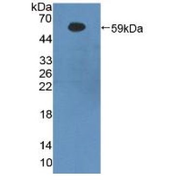 Beta-Site APP Cleaving Enzyme 1 (bACE1) Human Polyclonal Antibody