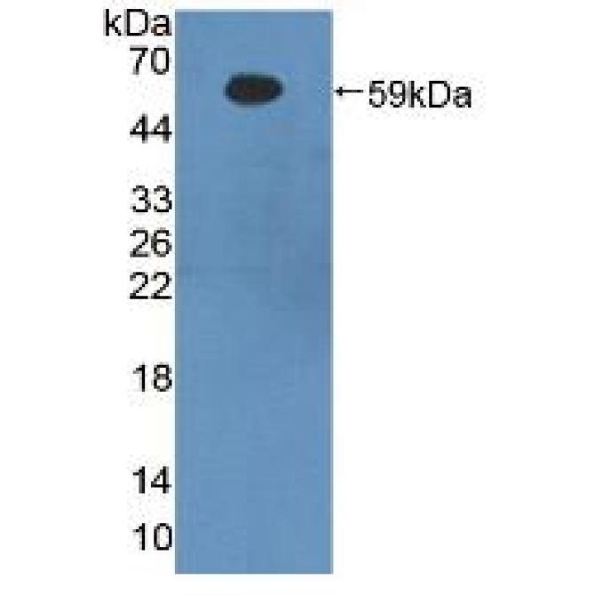 Beta-Site APP Cleaving Enzyme 1 (bACE1) Human Polyclonal Antibody