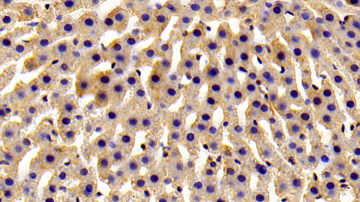 ADP Ribosyltransferase 4 (ART4) Rat Polyclonal Antibody