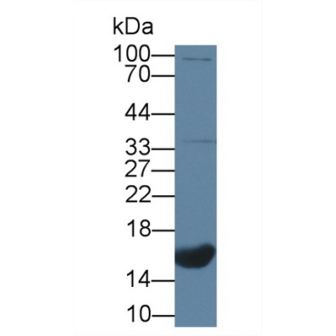 C-Type Natriuretic Peptide (CNP) Human Polyclonal Antibody