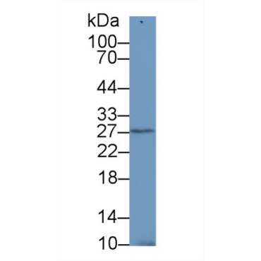 Stromal Cell Derived Factor 4 (SDF4) Human Polyclonal Antibody