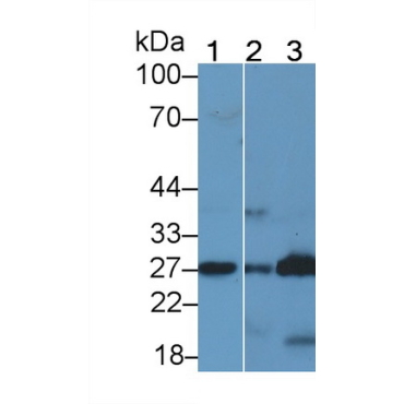 Prostaglandin-H2 D-isomerase (PTGDS) Human Polyclonal Antibody