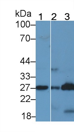 Prostaglandin-H2 D-isomerase (PTGDS) Human Polyclonal Antibody