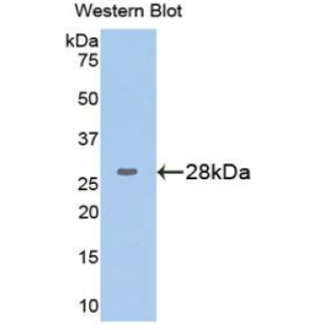 Glucose 6 Phosphate Isomerase (GPI) Human Polyclonal Antibody