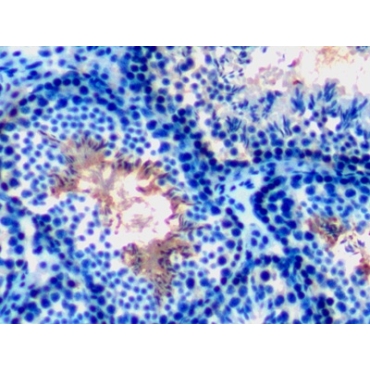 Glucose 6 Phosphate Isomerase (GPI) Mouse Polyclonal Antibody