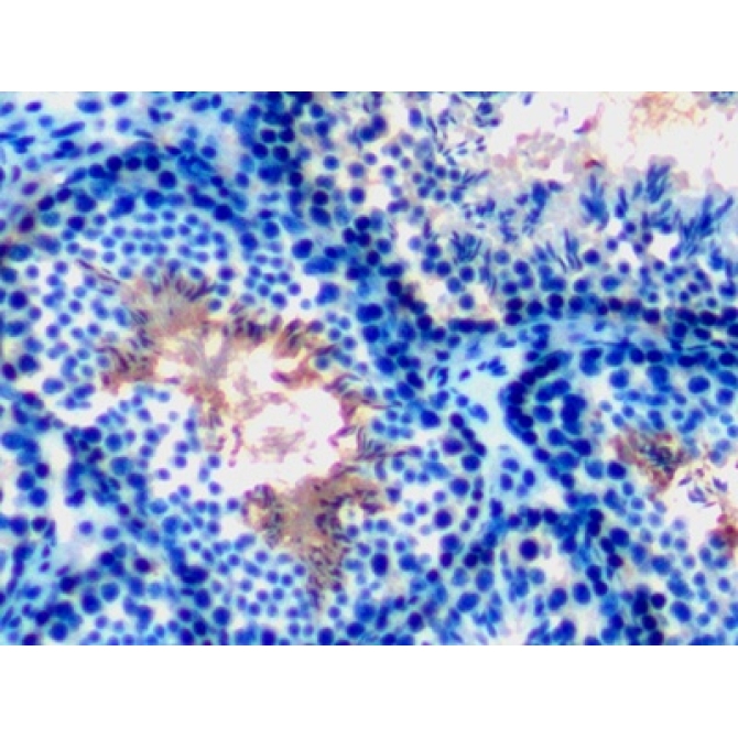Glucose 6 Phosphate Isomerase (GPI) Mouse Polyclonal Antibody