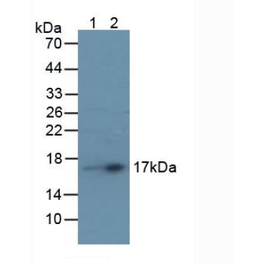 Prealbumin (PALB) Human Polyclonal Antibody