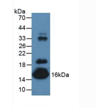Prealbumin (PALB) Mouse Polyclonal Antibody