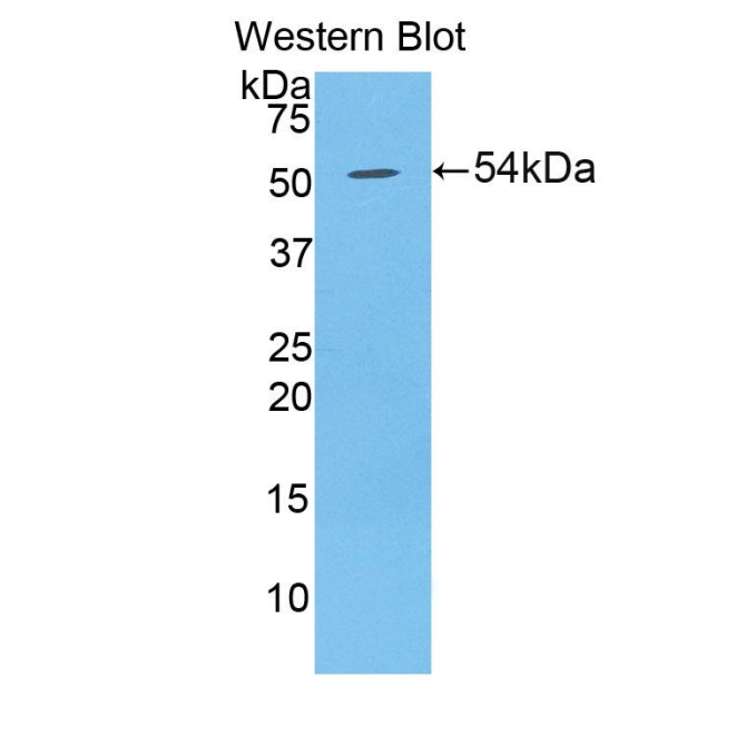 Desmoglein 1 (DSG1) Human Polyclonal Antibody