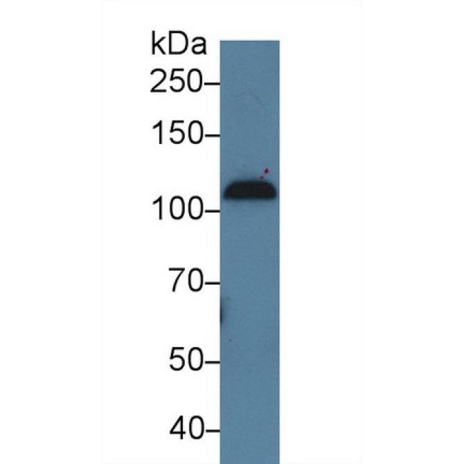 Complement Component 7 (C7) Human Polyclonal Antibody