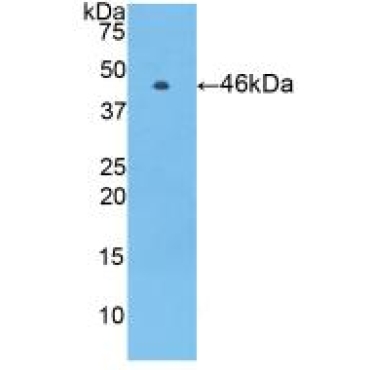 Protein C (PROC) Human Polyclonal Antibody