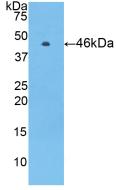 Protein C (PROC) Human Polyclonal Antibody
