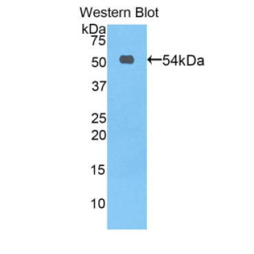 Protein C (PROC) Mouse Polyclonal Antibody