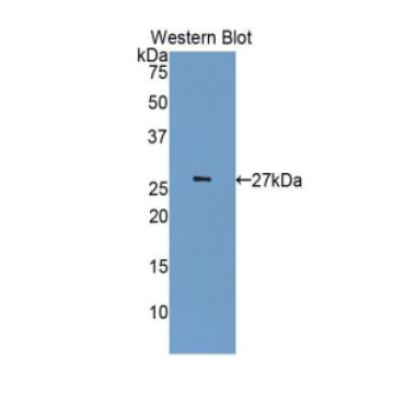 Cyclin Dependent Kinase 5 (CDK5) Human Polyclonal Antibody