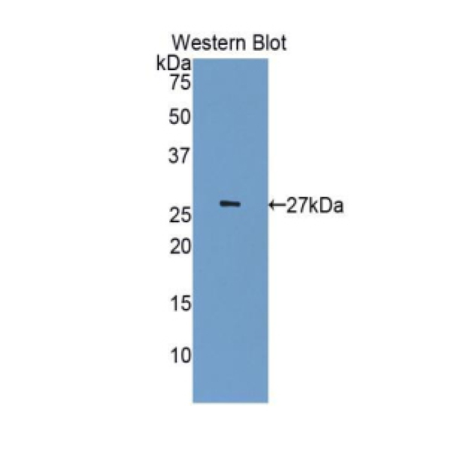 Cyclin Dependent Kinase 5 (CDK5) Human Polyclonal Antibody