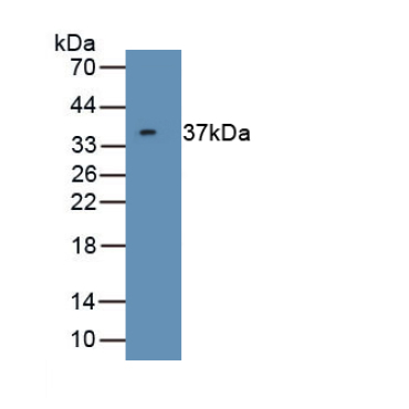 Cyclin Dependent Kinase 5 (CDK5) Human Polyclonal Antibody
