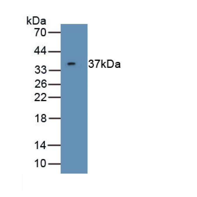 Cyclin Dependent Kinase 5 (CDK5) Human Polyclonal Antibody