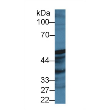 Prostaglandin I Synthase (PTGIS) Human Polyclonal Antibody