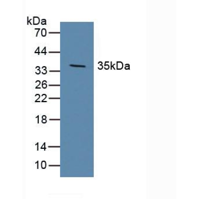 Dickkopf Related Protein 1 (DKK1) Human Polyclonal Antibody