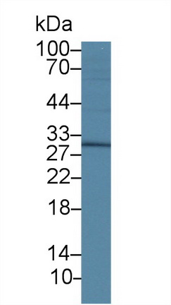 Dickkopf Related Protein 1 (DKK1) Rat Polyclonal Antibody