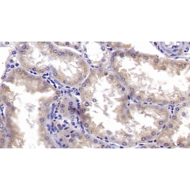 Metallothionein 3 (MT3) Human Polyclonal Antibody
