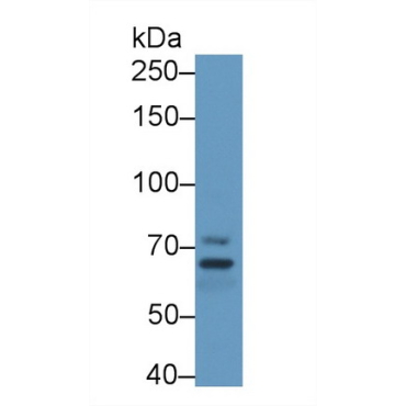 Membrane Protein, Palmitoylated 5 (MPP5) Human Polyclonal Antibody