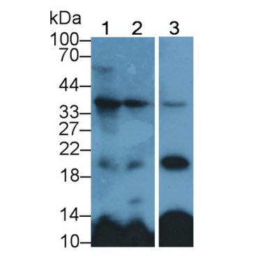 Fibroblast Growth Factor 23 (FGF23) Human Polyclonal Antibody