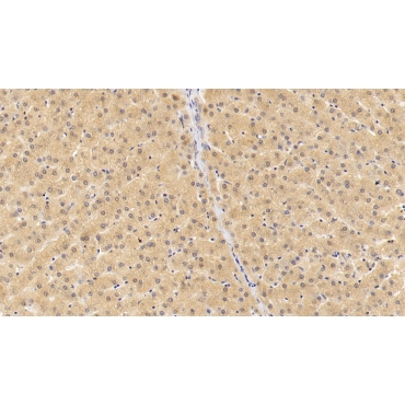 Fibroblast Growth Factor 23 (FGF23) Human Polyclonal Antibody