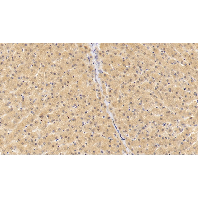 Fibroblast Growth Factor 23 (FGF23) Human Polyclonal Antibody