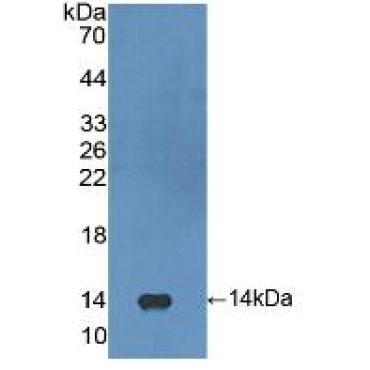 Fibroblast Growth Factor 23 (FGF23) Human Polyclonal Antibody
