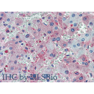 Complement 1q (C1q) Human Polyclonal Antibody