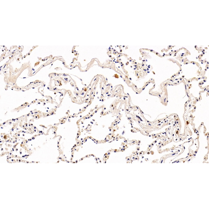 Programmed Cell Death Protein 1 (PD1) Human Polyclonal Antibody